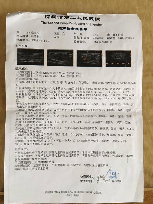 A miracle after continuously listening to the dharma discourse and cultivating, and practice according to the teachings by H.H. Dorje Chang Buddha III: The tumor in my thyroid gland has mysteriously diminished.
